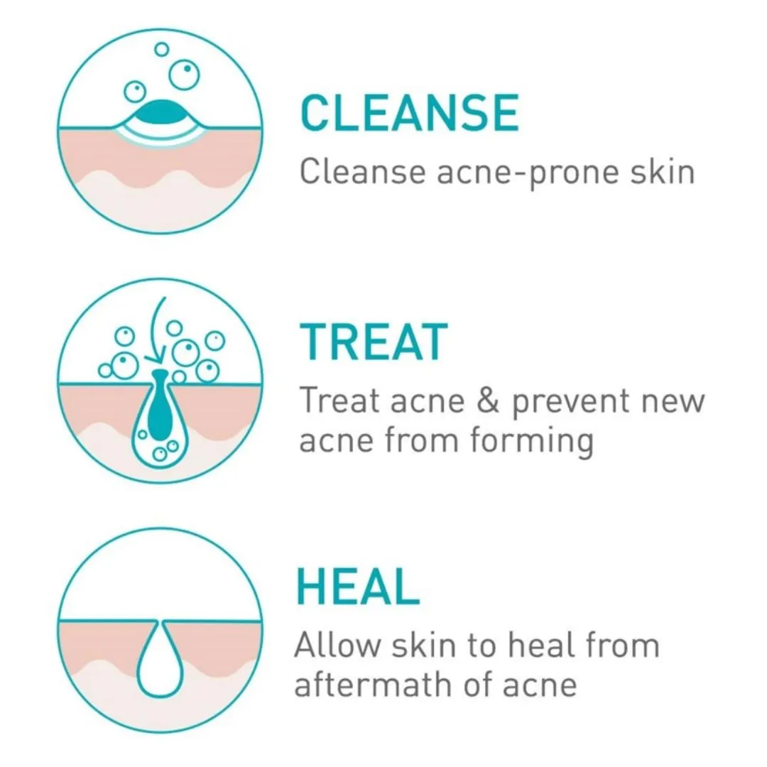 CeraVe Acne Foaming Cream Cleanser 150 ml.