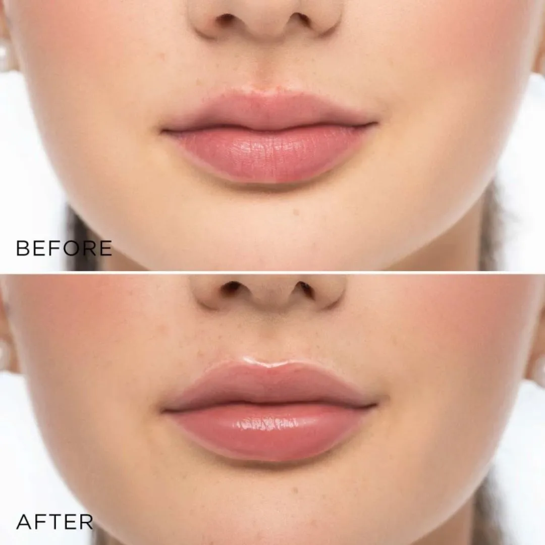 Glossy Lip Volumizer